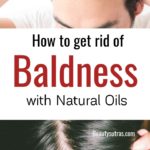 How to get rid of bald hair
