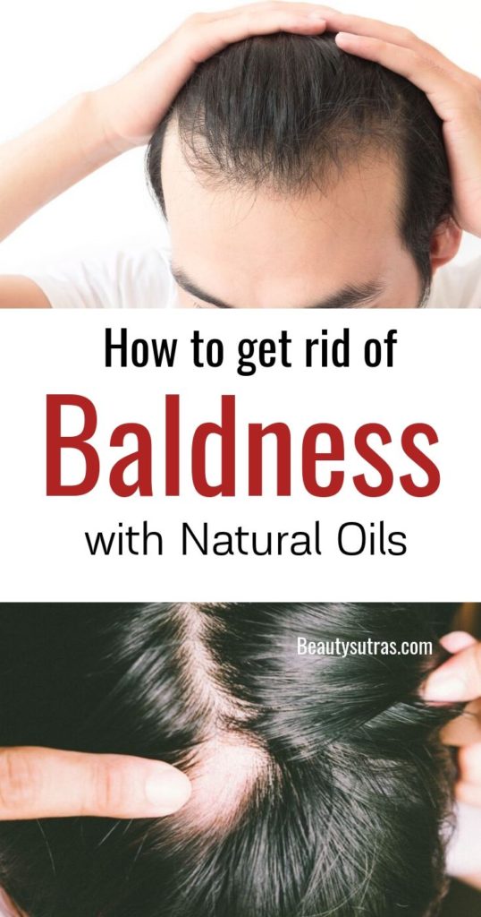 How to get rid of bald hair