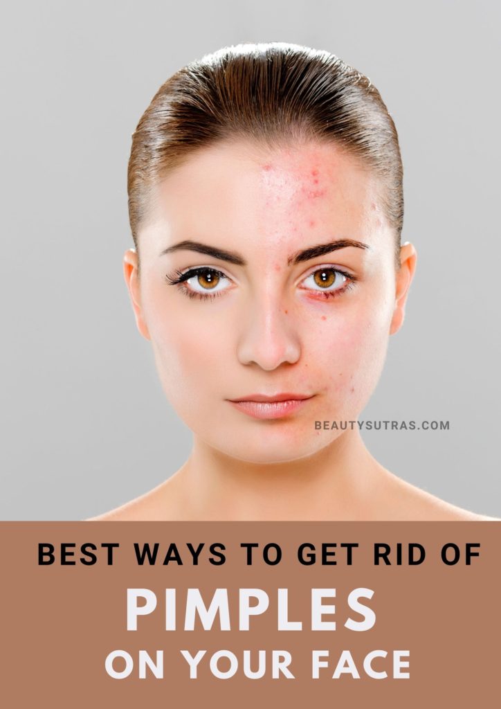 how to get rid of pimples on face