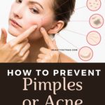 How to prevent pimples or acne