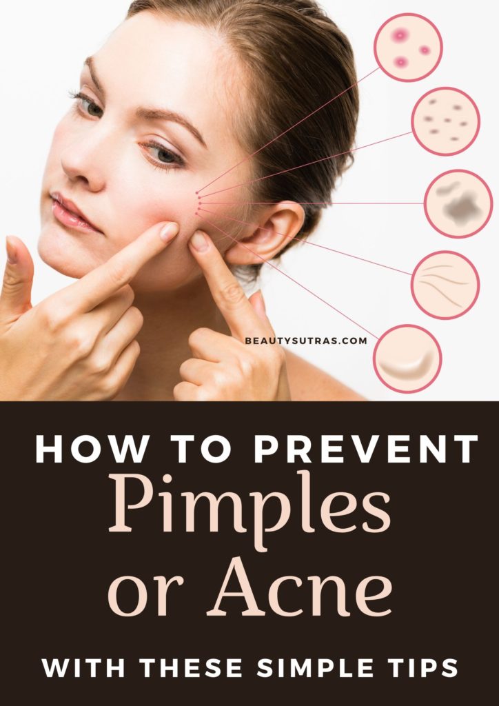 What Can I Use To Stop Pimples On My Face