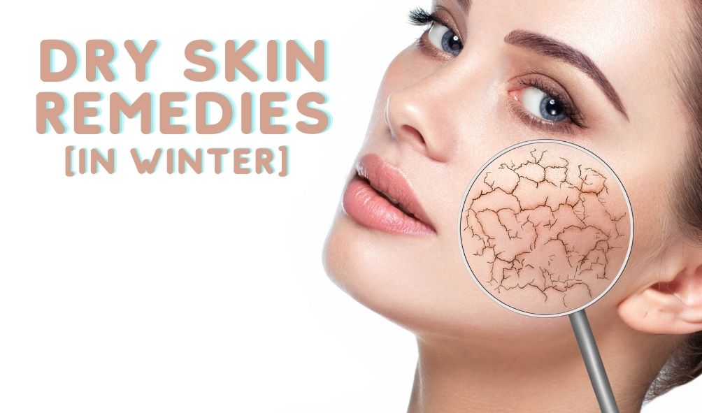 dry skin remedies in winter
