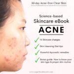 30 day Acne-free Skin
